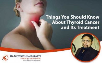 Things You Should Know About Thyroid Cancer and Treatment