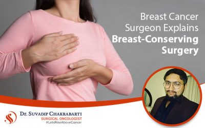 Breast Cancer Surgeon Explains Breast – Conserving Surgery