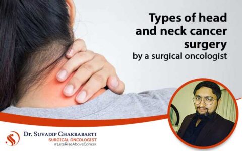 Head And Neck Cancer Treatment : Types Of Surgeries