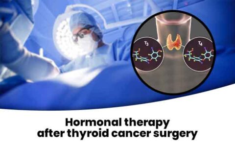 Hormonal therapy after thyroid cancer surgery