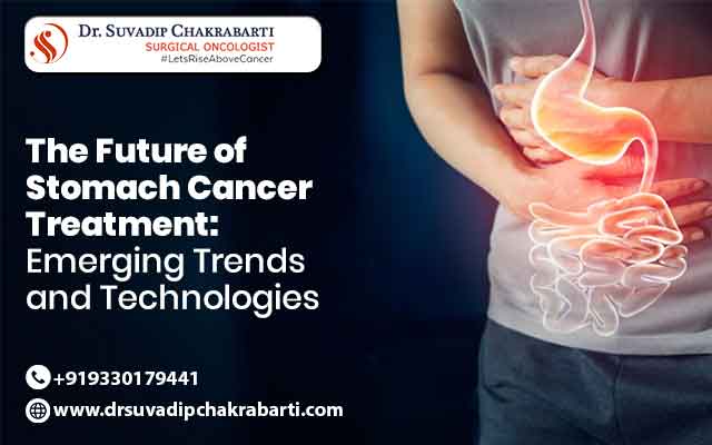 The Future of Stomach Cancer Treatment: Emerging Trends and Technologies