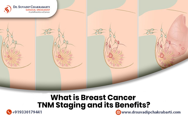 breast cancer tnm staging