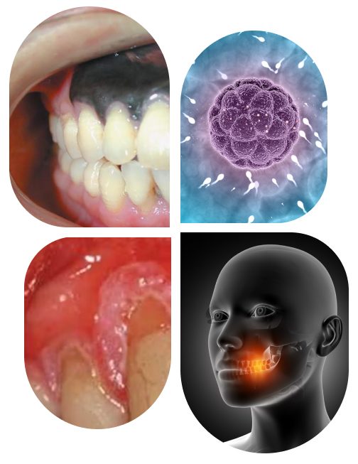 Oral Cavity