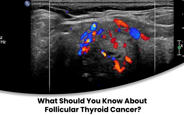 thyroid cancer types