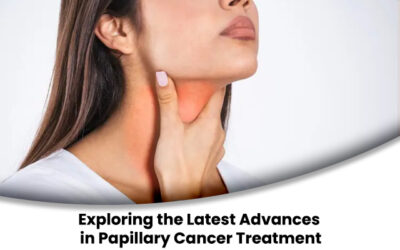 Exploring the Latest Advances in Papillary Cancer Treatment